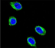 Immunofluorescent staining of human HEK293 cells with CCHCR1 antibody (green) and DAPI nuclear stain (blue).