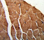 IHC testing of FFPE human skeletal muscle tissue with CCHCR1 antibody. HIER: steam section in pH6 citrate buffer for 20 min and allow to cool prior to staining.
