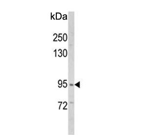 Western blot testing of human MCF7 cell lysate with VPS53 antibody. Predicted molecular weight ~94 kDa.