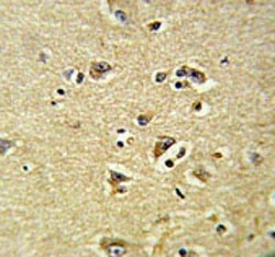 IHC testing of FFPE human brain tissue with VPS53 antibody. HIER: steam section in pH6 citrate buffer for 20 min and allow to cool prior to staining.