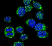 Immunofluorescent staining of human HeLa cells with CALM1 antibody (green) and DAPI nuclear stain (blue).