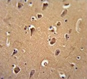 IHC testing of FFPE human brain tissue with CALM1 antibody. HIER: steam section in pH6 citrate buffer for 20 min and allow to cool prior to staining.