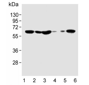 Western blot testing of human 1) HeLa, 2) 293T, 3) Jurkat, 4) brain, 5) heart and 6) K562 cell lysate with Interferon alpha receptor 1 antibody. Expected molecular weight: 64-135 kDa depending on glycosylation level.