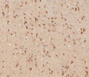 IHC testing of FFPE human brain tissue with Interferon alpha receptor 1 antibody. HIER: steam section in pH9 EDTA buffer for 20 min and allow to cool prior to staining.