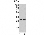 Western blot testing of human 1) K562 and 2) HL60 cell lysate with Bcl-2-like protein 11 antibody. Predicted molecular weight ~22 kDa.