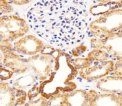 IHC testing of FFPE human kidney tissue with Bcl-2-like protein 11 antibody. HIER: steam section in pH6 citrate buffer for 20 min and allow to cool prior to staining.