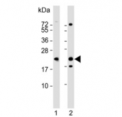 Western blot testing of human 1) A431 and 2) Raji cell lysate with PSMB9 antibody. Predicted molecular weight ~23 kDa.