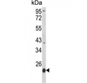 Western blot testing of human HL60 cell lysate with PSMB9 antibody. Predicted molecular weight ~23 kDa.