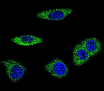 Immunofluorescent staining of fixed human MDA-MB-231 cells with Alpha-2B Adrenergic Receptor antibody (green) and DAPI nuclear stain (blue).