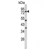Western blot testing of mouse NIH 3T3 cell lysate with PKC alpha antibody. Predicted molecular weight ~77 kDa.