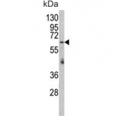 Western blot testing of human HepG2 cell lysate with RARS2 antibody. Predicted molecular weight ~66 kDa.