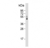 Western blot testing of human HepG2 cell lysate with HPD antibody. Predicted molecular weight ~45 kDa.