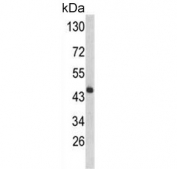 Western blot testing of mouse liver tissue lysate with HPD antibody. Predicted molecular weight ~45 kDa.