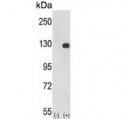 Western blot testing of 1) non-transfected and 2) transfected 293 cell lysate with PTK2 antibody.