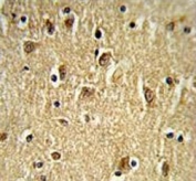 IHC testing of FFPE human brain tissue with PTK2 antibody. HIER: steam section in pH6 citrate buffer for 20 min and allow to cool prior to staining.