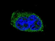 Immunofluorescent staining of human MDA-MB-231 cells with TSH beta antibody (green) and DAPI nuclear stain (blue).