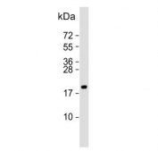 Western blot testing of human MDA-MB-231 cell lysate with TSH beta antibody. Predicted molecular weight ~16 kDa.