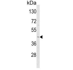 Western blot testing of human Y79 cell lysate with Adiponectin receptor 1 antibody. Predicted molecular weight ~43 kDa.