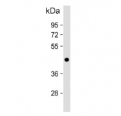 Western blot testing of human MCF7 cell lysate with Adiponectin receptor 1 antibody. Predicted molecular weight ~43 kDa.