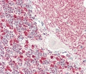 IHC testing of FFPE human cerebellum tissue with Kinesin light chain 1 antibody. HIER: steam section in pH6 citrate buffer for 20 min and allow to cool prior to staining.