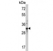Western blot testing of human MDA-MB-231 cell lysate with Max-like protein X antibody. Predicted molecular weight ~33 kDa, commonly observed at 30-50 kDa.