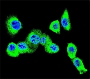 Immunofluorescent staining of human MDA-MB-231 cells with CAV2 antibody (green) and DAPI nuclear stain (blue).