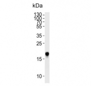 Western blot testing of human HUVEC lysate with CAV2 antibody. Predicted molecular weight ~18 kDa.