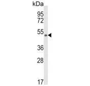 Western blot testing of human CCRF-CEM cell lysate with KMO antibody. Expected molecular weight: 52-56 kDa (multiple isoforms).