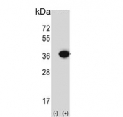 Western blot testing of 1) non-transfected and 2) transfected 293 cell lysate with Mitochondrial amidoxime reducing component 2 antibody.