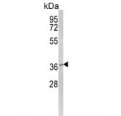 Western blot testing of human HeLa cell lysate with Mitochondrial amidoxime reducing component 2 antibody. Predicted molecular weight ~38 kDa.