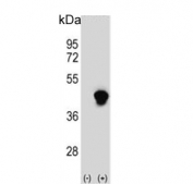 Western blot testing of 1) non-transfected and 2) transfected 293 cell lysate with Enoyl-CoA delta isomerase 2 antibody.