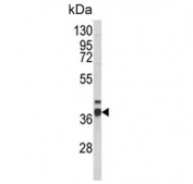 Western blot testing of human HepG2 cell lysate with Enoyl-CoA delta isomerase 2 antibody. Predicted molecular weight ~44 kDa.