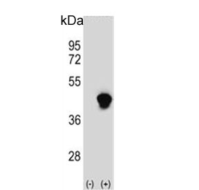 Western blot testing of 1) non-transfected and 2) transfected 293 cell lysate with Enoyl-CoA delta isomerase 2 antibody.