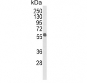Western blot testing of human MDA-MB-231 cell lysate with Aldehyde dehydrogenase family 3 member B1 antibody. Predicted molecular weight ~52 kDa.