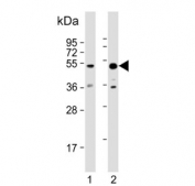 Western blot testing of human 1) kidney and 2) K562 cell lysate with Aldehyde dehydrogenase family 3 member B1 antibody. Predicted molecular weight ~52 kDa.