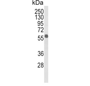 Western blot testing of human MDA-MB-231 cell lysate with Aldehyde dehydrogenase family 3 member B1 antibody. Predicted molecular weight ~52 kDa.
