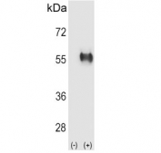 Western blot testing of 1) non-transfected and 2) transfected 293 cell lysate with Aldehyde dehydrogenase family 3 member B1 antibody.