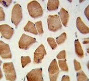 IHC testing of FFPE human skeletal muscle tissue with PHYH antibody. HIER: steam section in pH6 citrate buffer for 20 min and allow to cool prior to staining.