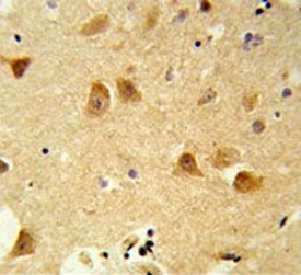 IHC testing of FFPE human brain tissue with Derlin 1 antibody. HIER: steam section in pH6 citrate buffer for 20 min and allow to cool prior to staining.