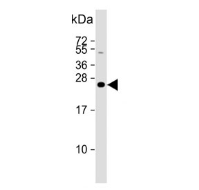 Western blot testing of human SK-BR-3 cell lysate with Derlin 1 antibody. Predicted molecular weight ~29 kDa.