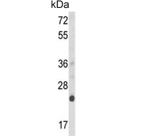 Western blot testing of mouse NIH 3T3 cell lysate with Derlin 1 antibody. Predicted molecular weight ~29 kDa.