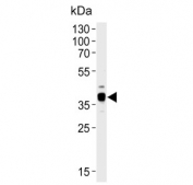 Western blot testing of human A431 cell lysate with ARPC1B antibody. Predicted molecular weight  ~41 kDa.