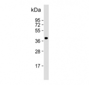 Western blot testing of human HeLa cell lysate with ARPC1B antibody. Predicted molecular weight  ~41 kDa.
