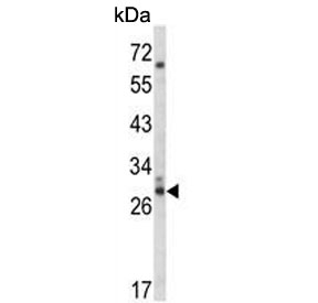 Western blot testing of human HEK293 cell lysate with CDC42EP3 antibody. Predicted molecular weight ~28 kDa.