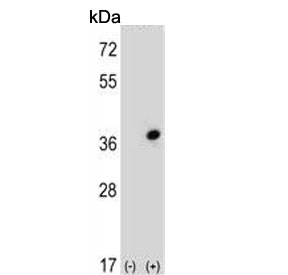 Western blot testing of 1) non-transfected and 2) transfected 293 cell lysate with CDC42EP3 antibody.