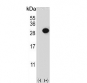 Western blot testing of 1) non-transfected and 2) transfected 293 cell lysate with CTHRC1 antibody.