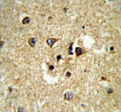 IHC testing of FFPE human brain tissue with CYP7B1 antibody. HIER: steam section in pH6 citrate buffer for 20 min and allow to cool prior to staining.