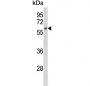 Western blot testing of human HeLa cell lysate with CYP7B1 antibody. Predicted molecular weight ~58 kDa.