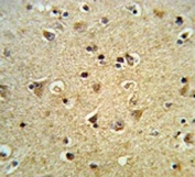 IHC testing of FFPE human brain tissue with PPIase D antibody. HIER: steam section in pH6 citrate buffer for 20 min and allow to cool prior to staining.