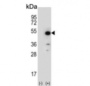 Western blot testing of 1) non-transfected and 2) transfected 293 cell lysate with PPIase D antibody.